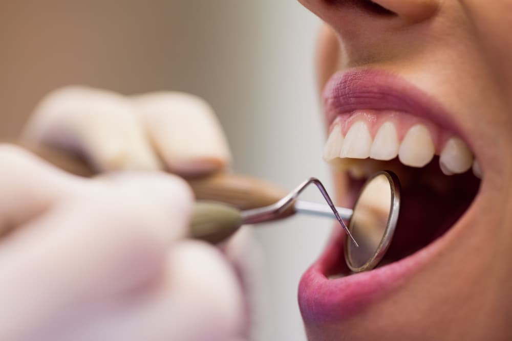 Smiles 4 Life Dental & Braces - How to Choose the Right Dentist in Thousand Oaks