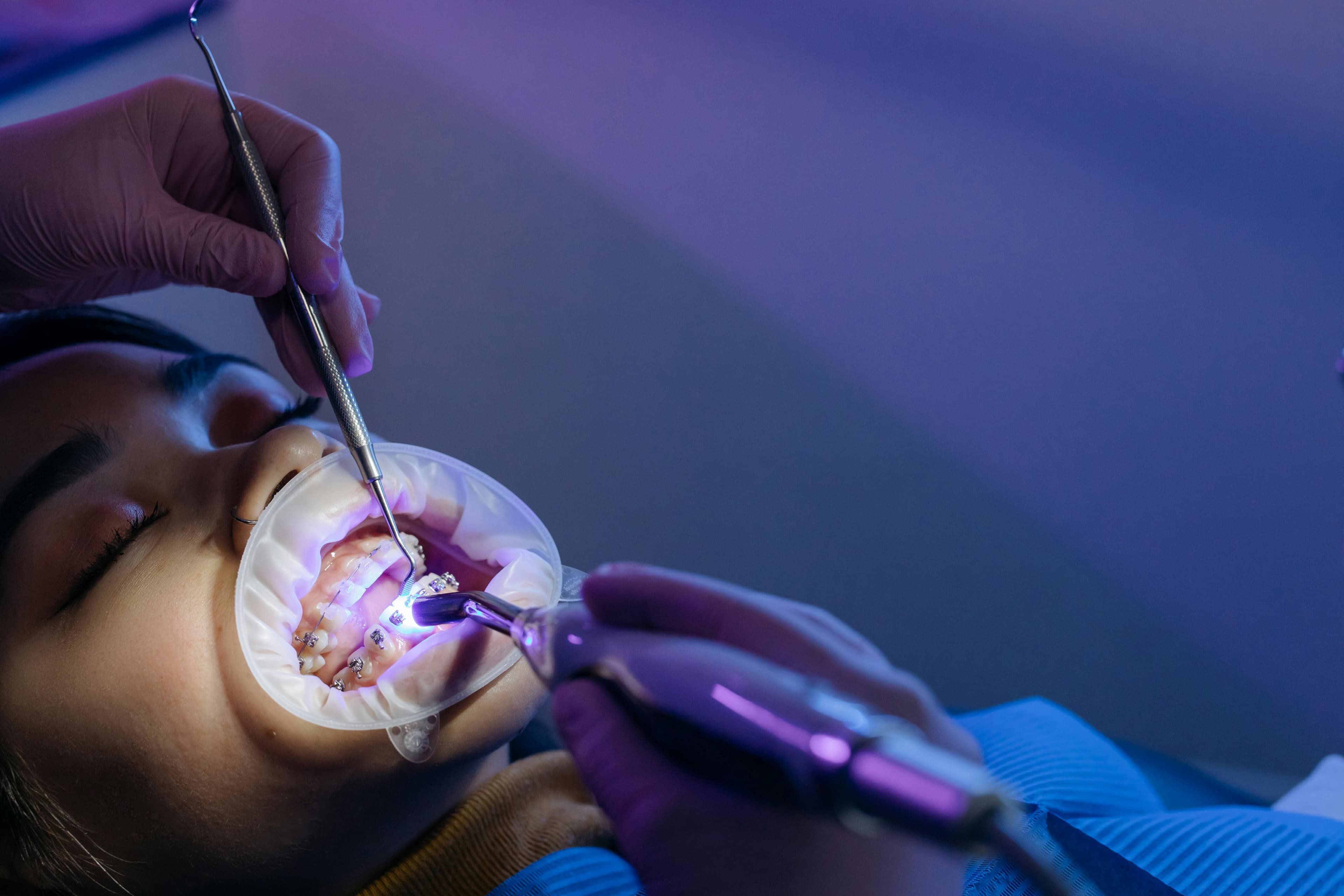Orthodontist Near You in Thousand Oaks: Straight Teeth, No Referral Needed