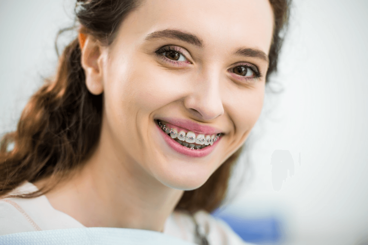 Braces for Adults