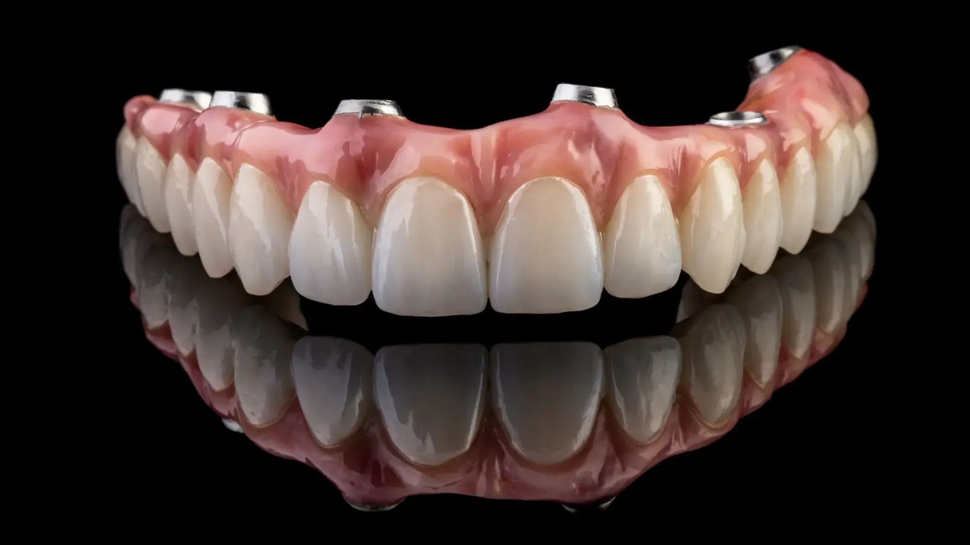 Full Arch Dental Implants
