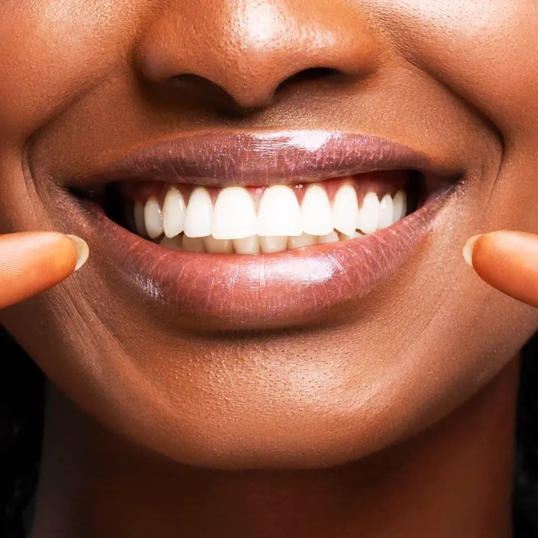 Full Mouth Reconstruction