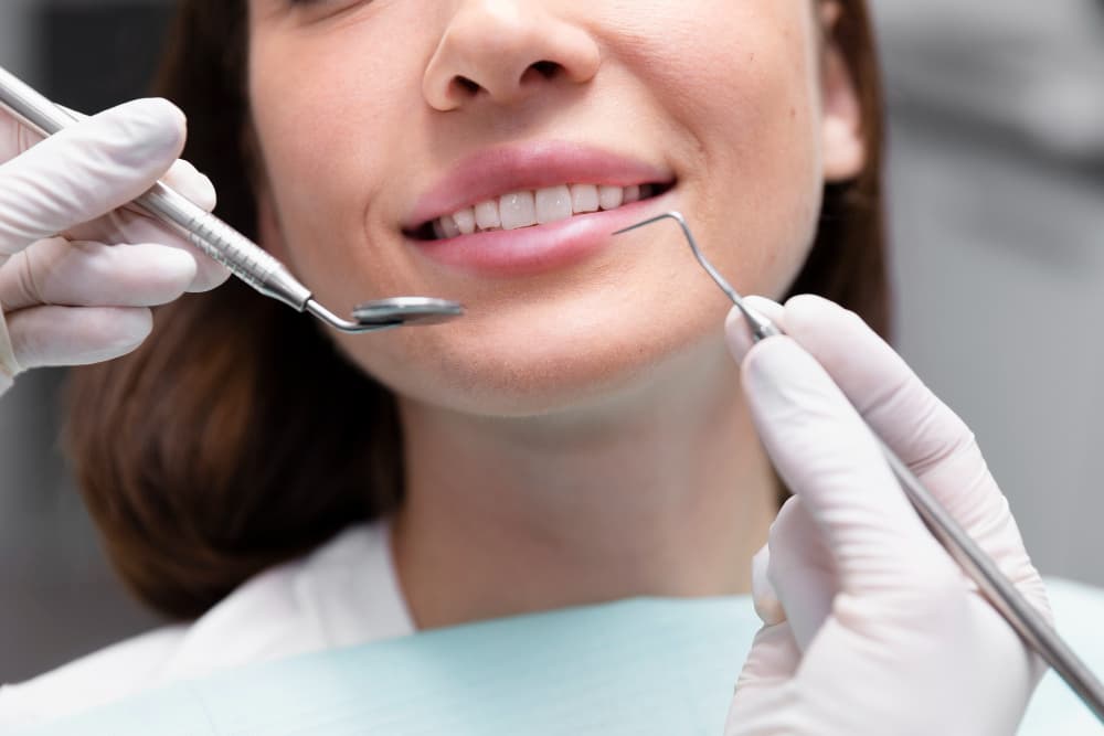 Gingivectomy