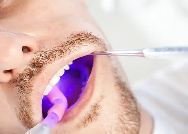 Oral Cancer Screening