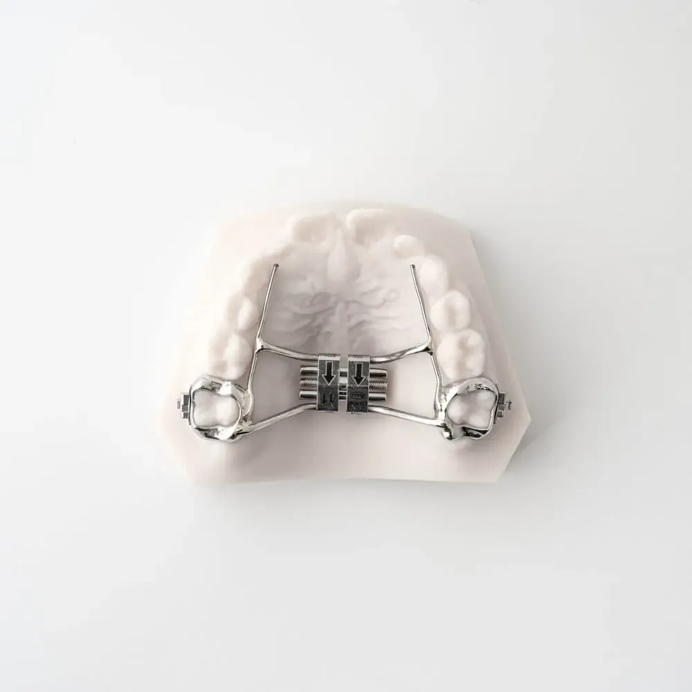 Palatal Expander
