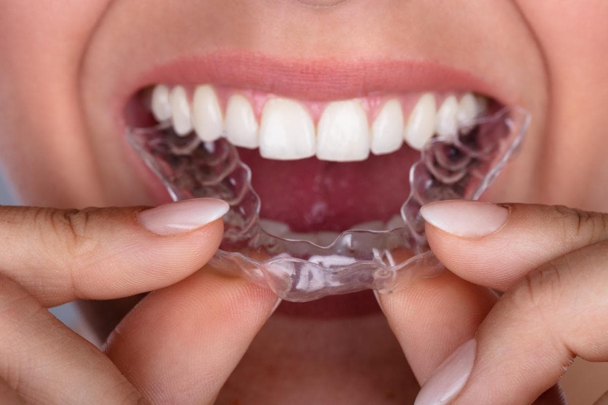 Retainers