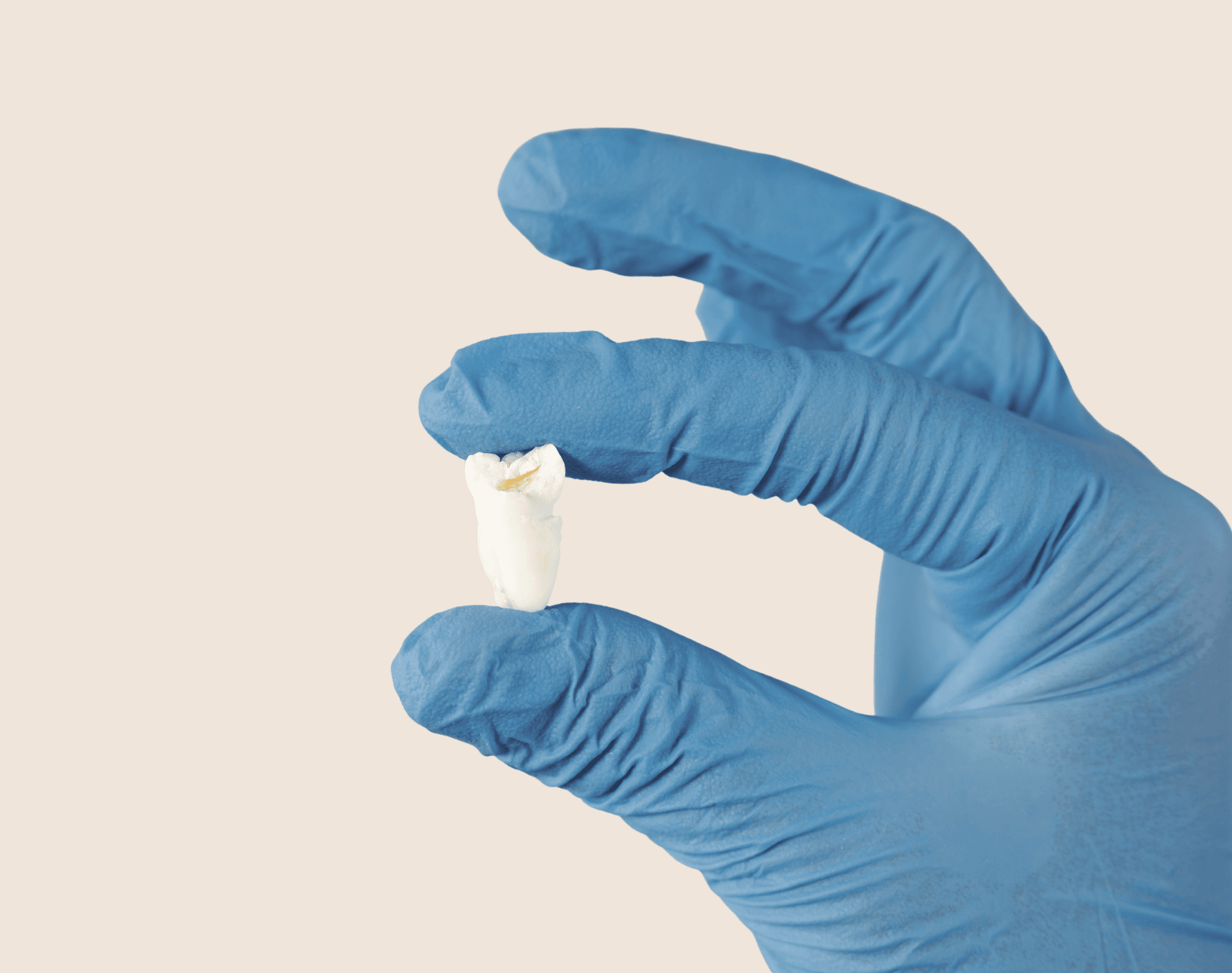 Tooth Pain treatment at Smiles4Life Dental & Braces, Thousand Oaks